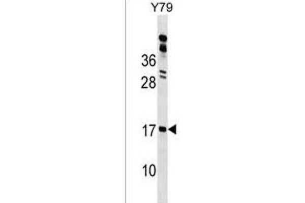 GLIPR2 anticorps  (N-Term)