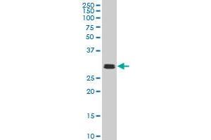 TAF11 monoclonal antibody (M04), clone 2G9 Western Blot analysis of TAF11 expression in Hela S3 NE . (TAF11 anticorps  (AA 158-210))