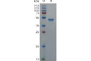 Human F Protein, hFc Tag on SDS-PAGE under reducing condition. (GDNF Protein (AA 78-211) (Fc Tag))