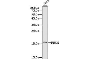 Western blot analysis of extracts of HeLa cells, using IFITM2 antibody (ABIN7267949) at 1:1000 dilution. (IFITM2 anticorps  (AA 1-100))