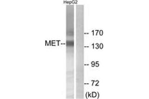 Western Blotting (WB) image for anti-Met Proto-Oncogene (MET) (AA 1201-1250) antibody (ABIN2889028) (c-MET anticorps  (AA 1201-1250))