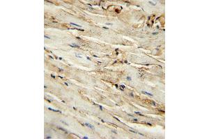 immunohistochemistry analysis in formalin fixed and paraffin embedded mouse heart tissue followed by peroxidase conjugation of the secondary antibody and DAB staining. (Endoglin anticorps  (AA 380-409))