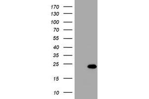 Image no. 1 for anti-Visinin-Like 1 (VSNL1) (AA 2-191) antibody (ABIN1491144) (VSNL1 anticorps  (AA 2-191))