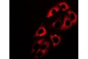 Immunofluorescent analysis of ADH5 staining in HepG2 cells. (ADH5 anticorps)