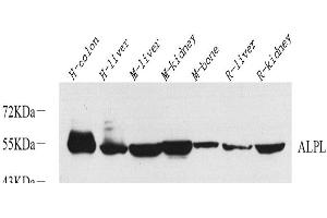 Western Blot analysis of various samples using ALPL Polyclonal Antibody at dilution of 1:1000. (ALPL anticorps)