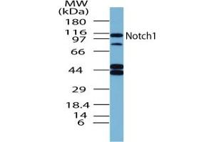 Image no. 1 for anti-Notch 1 (NOTCH1) (AA 1755-1767) antibody (ABIN207749) (Notch1 anticorps  (AA 1755-1767))