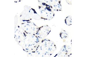 Immunohistochemistry of paraffin-embedded human placenta using RCC1 Rabbit mAb (ABIN1512845, ABIN3021028, ABIN3021029 and ABIN7101332) at dilution of 1:100 (40x lens). (RCC1 anticorps)