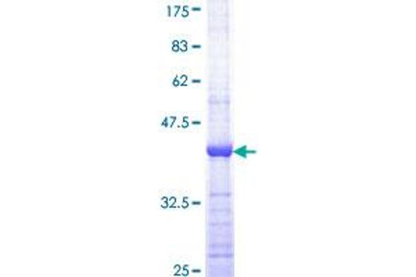 CDK7 Protein (AA 1-130) (GST tag)