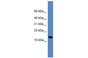 WB Suggested Anti-UFM1 Antibody Titration: 0. (UFM1 anticorps  (Middle Region))