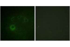Immunofluorescence analysis of COS7 cells, using p70 S6 Kinase (Phospho-Ser418) Antibody. (RPS6KB1 anticorps  (pSer418))