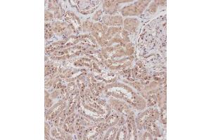 Immunohistochemical analysis of B on paraffin-embedded Human kidney tissue. (RPL23A anticorps  (C-Term))