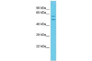 Host: Rabbit Target Name: TMEM143 Sample Type: Jurkat Whole Cell lysates Antibody Dilution: 1. (TMEM143 anticorps  (C-Term))