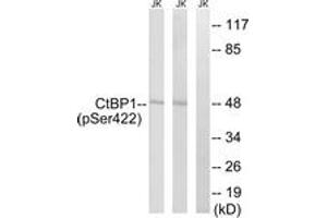 Western blot analysis of extracts from Jurkat cells treated with TNF 20ng/ml 30' and Jurkat cells treated with UV 15', using CtBP1 (Phospho-Ser422) Antibody. (CTBP1 anticorps  (pSer422))