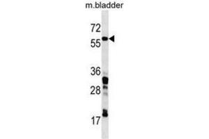 Western Blotting (WB) image for anti-Coronin, Actin Binding Protein, 1C (CORO1C) antibody (ABIN3000410) (CORO1C anticorps)