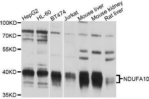 Western blot analysis of extracts of various cells, using NDUFA10 antibody. (NDUFA10 anticorps)