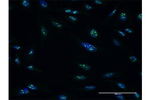 Immunofluorescence of purified MaxPab antibody to PES1 on HeLa cell. (PES1 anticorps  (AA 1-588))