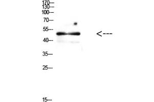Western Blot analysis of mouse brain cells using Antibody diluted at 1:500. (E2F1 anticorps  (AA 100-170))