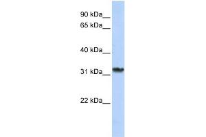 WB Suggested Anti-SMNDC1 Antibody Titration:  0. (SMNDC1 anticorps  (C-Term))