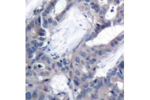 Immunohistochemistry (IHC) image for anti-Mitogen-Activated Protein Kinase Kinase 2 (MAP2K2) (pThr394) antibody (ABIN3019566) (MEK2 anticorps  (pThr394))