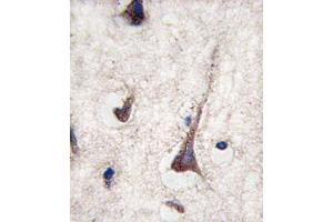 Immunohistochemistry (IHC) image for anti-CD3g Molecule, gamma (CD3-TCR Complex) (CD3G) antibody (ABIN2998378) (CD3G anticorps)