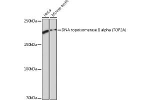 Western blot analysis of extracts of various cell lines, using DNA DNA topoisomerase II alpha (TOP2A) (TOP2A) Rabbit mAb (ABIN7270852) at 1:1000 dilution. (Topoisomerase II alpha anticorps)