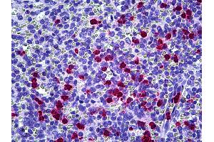 Anti-CAMP antibody IHC of human spleen, neutrophils. (Cathelicidin anticorps)