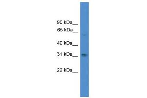 WB Suggested Anti-RUNX2 Antibody Titration:  0. (RUNX2 anticorps  (N-Term))