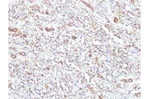 Immunohistochemistry (Formalin-fixed Paraffin-embedded Sections) (IHC (fp)) image for anti-Vimentin (VIM) antibody (ABIN3026904)