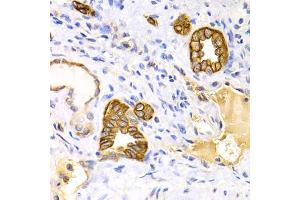 Immunohistochemistry of paraffin-embedded human kidney using KRT15 antibody. (KRT15 anticorps)