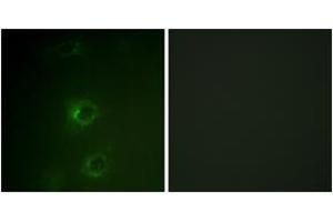 Immunofluorescence analysis of COS7 cells, using CBL (Ab-700) Antibody. (CBL anticorps  (AA 666-715))