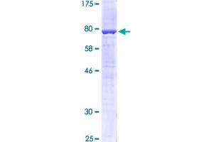 Image no. 1 for Keratin 6A (KRT6A) (AA 1-564) protein (GST tag) (ABIN1309016) (KRT6A Protein (AA 1-564) (GST tag))