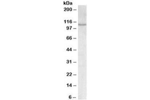 Western blot testing of MOLT4 lysate with NFATC2 antibody at 0. (NFAT1 anticorps)