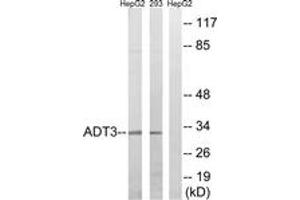 Western blot analysis of extracts from HepG2/293 cells, using SLC25A6 Antibody. (SLC25A6 anticorps  (AA 121-170))