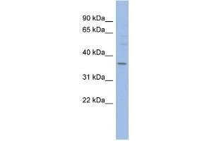 WB Suggested Anti-HMGCLL1 Antibody Titration: 0. (HMGCLL1 anticorps  (N-Term))