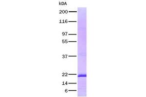 Validation with Western Blot (FGF7 Protéine)