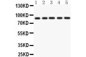 Anti- CD36 Picoband antibody, Western blotting All lanes: Anti CD36  at 0. (CD36 anticorps  (N-Term))