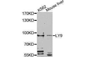 Western blot analysis of extracts of K562 and mouse liver cells, using LY9 antibody. (LY9 anticorps)