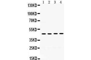 Western Blotting (WB) image for anti-Coagulation Factor II (thrombin) Receptor (F2R) (AA 46-82), (N-Term) antibody (ABIN3042380) (PAR1 anticorps  (N-Term))