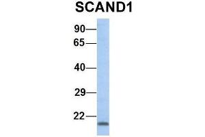 Host:  Rabbit  Target Name:  SCAND1  Sample Type:  Human 721_B  Antibody Dilution:  1. (SCAND1 anticorps  (N-Term))