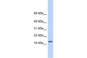 CDRT4 antibody used at 1 ug/ml to detect target protein. (CDRT4 anticorps  (Middle Region))