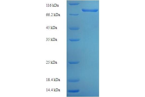 P4HA3 Protein (AA 20-544) (His-SUMO Tag)