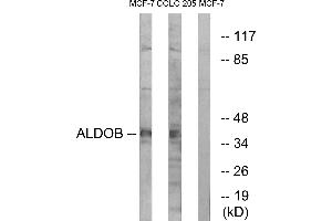 Western blot analysis of extracts from MCF-7 cells and HUVEC cells, using ALDOB antibody. (ALDOB anticorps  (Internal Region))