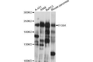Western blot analysis of extracts of various cell lines, using ITGB4 antibody (ABIN5970319) at 1/1000 dilution. (Integrin beta 4 anticorps)