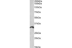 ABIN2564407 (1µg/ml) staining of Human Lymph Node lysate (35µg protein in RIPA buffer). (PCDH11Y anticorps  (Internal Region))
