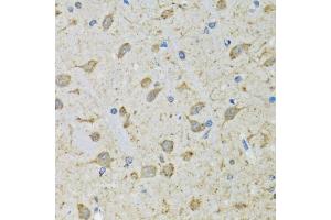 Immunohistochemistry of paraffin-embedded mouse brain using DHRS2 antibody (ABIN5973846) at dilution of 1/100 (40x lens). (DHRS2 anticorps)