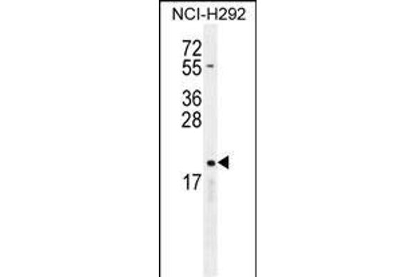 CYBA anticorps  (C-Term)