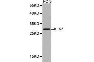 Western Blotting (WB) image for anti-Prostate Specific Antigen (PSA) antibody (ABIN1873444) (Prostate Specific Antigen anticorps)
