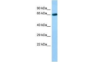 Host: Rabbit Target Name: ACOXL Sample Type: Fetal Liver lysates Antibody Dilution: 1. (ACOXL anticorps  (C-Term))