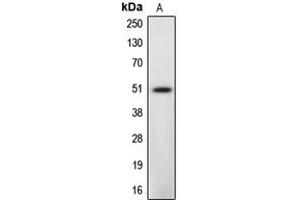 Western blot analysis of Caspase 12 expression in L929 (A) whole cell lysates. (Caspase 12 anticorps  (Center))
