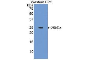 Western Blotting (WB) image for anti-Caldesmon 1 (CALD1) (AA 28-207) antibody (ABIN1858221) (Caldesmon anticorps  (AA 28-207))